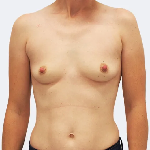 Image before
