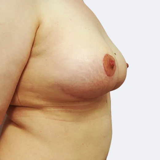 Image after