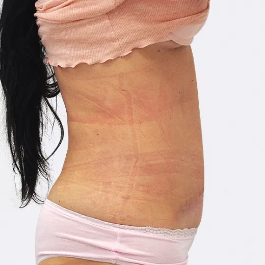 Image after