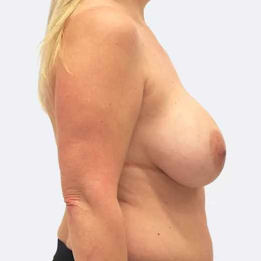 Image before