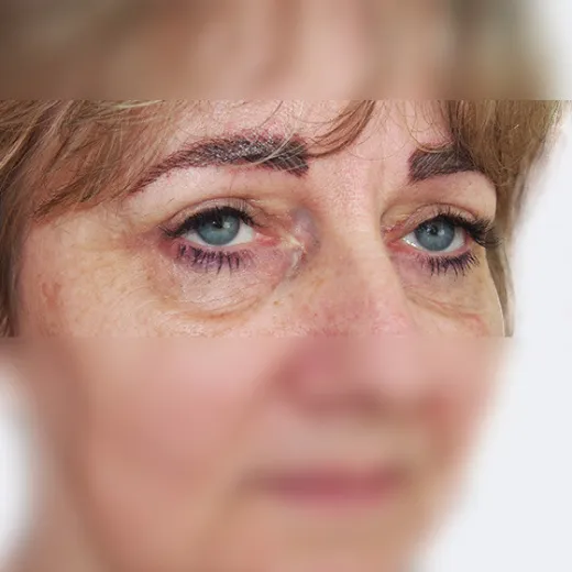 Image after