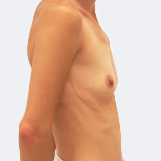 Image before