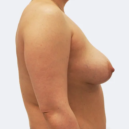 Image before