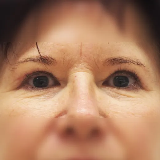 Image after