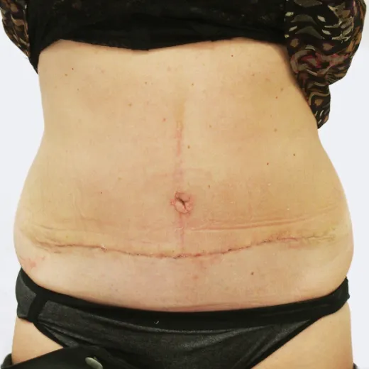 Image after