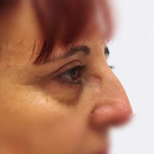 Image after