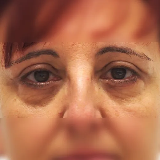 Image after