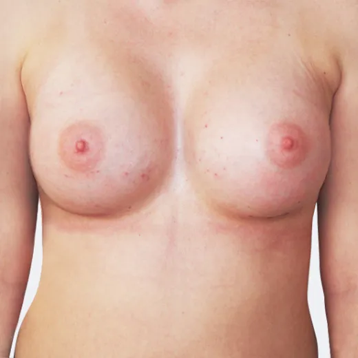 Image after