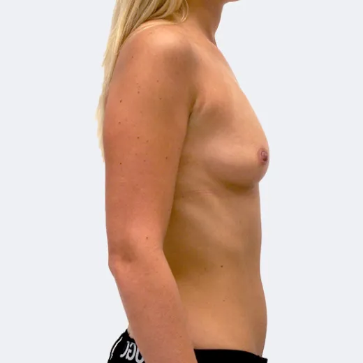 Image before