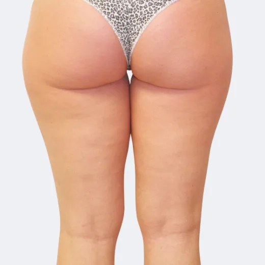 Image before