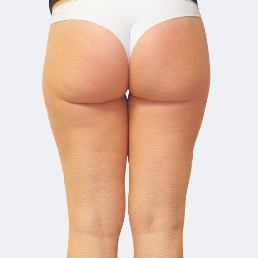 Image after