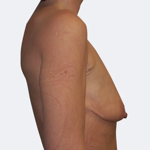 Image before