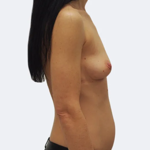 Image before