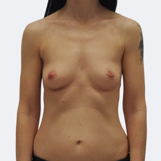 Image before
