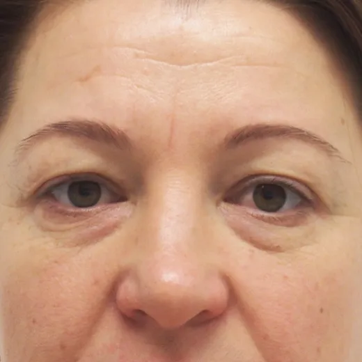 Image before