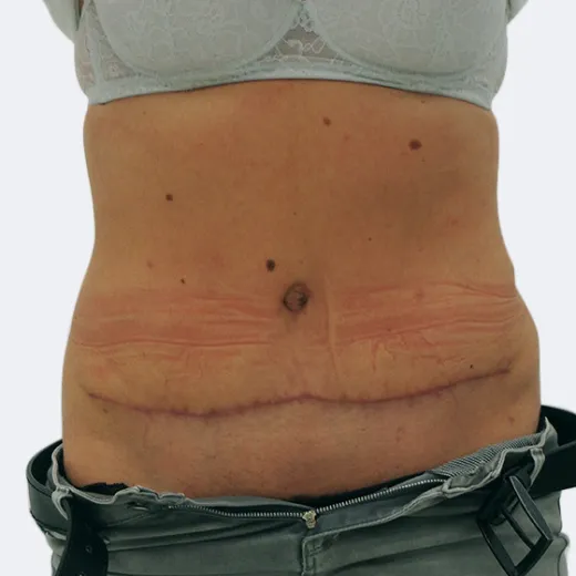 Image after