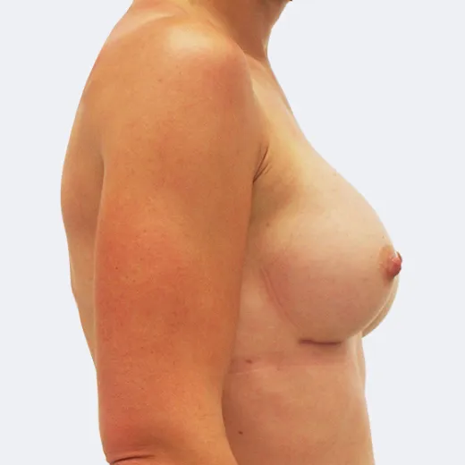 Image after