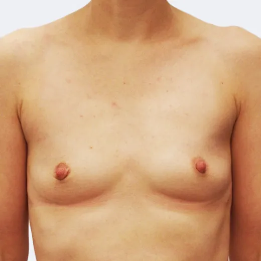 Image before