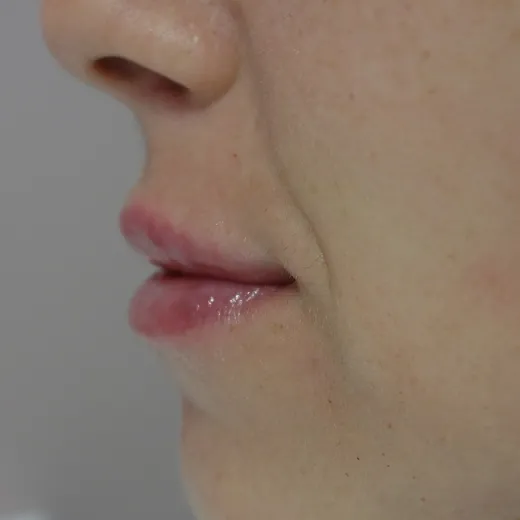 Image after