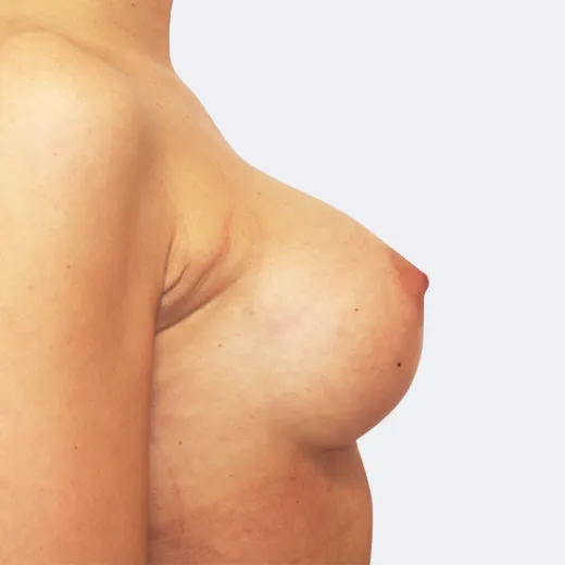 Image after