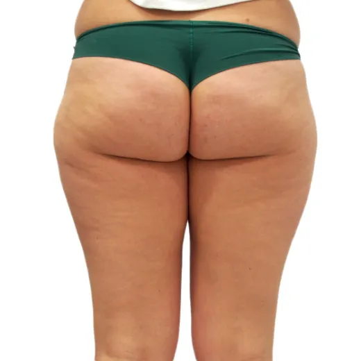 Image before