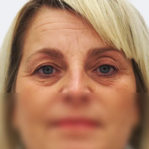 Image before