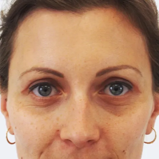 Image after