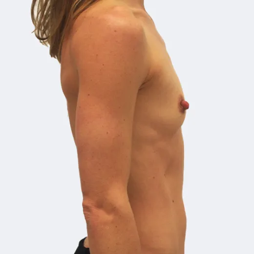 Image before