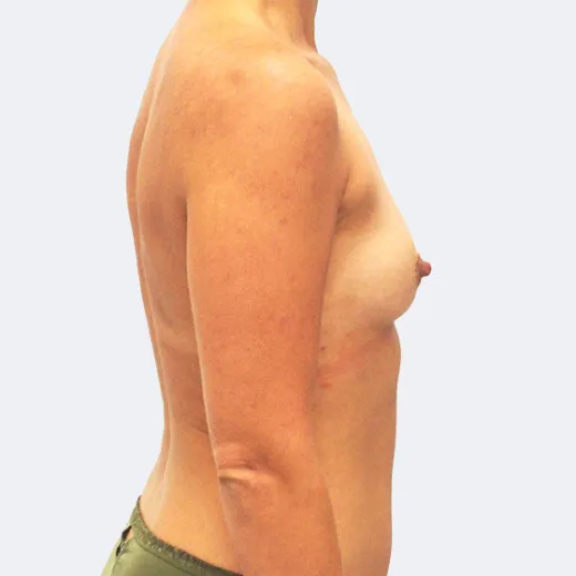 Image before