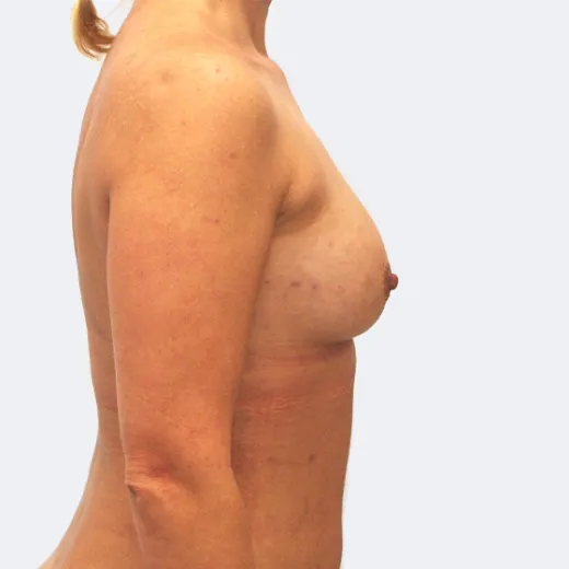 Image after