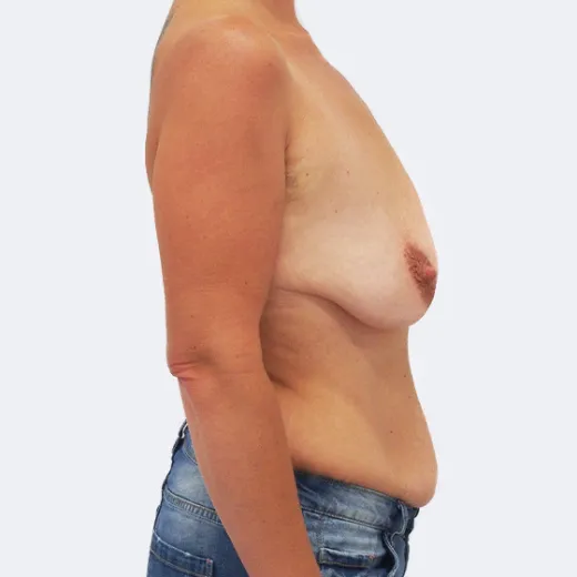 Image before