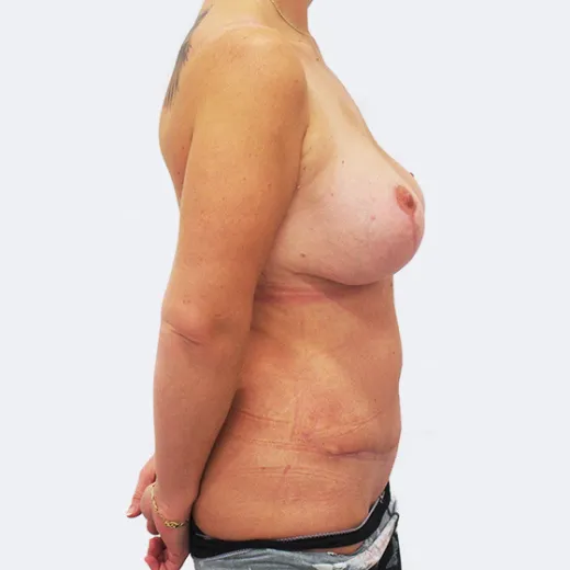 Image after