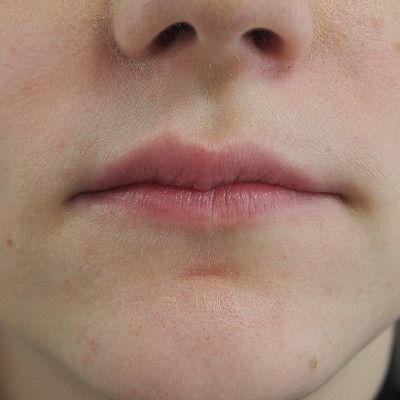 Image before