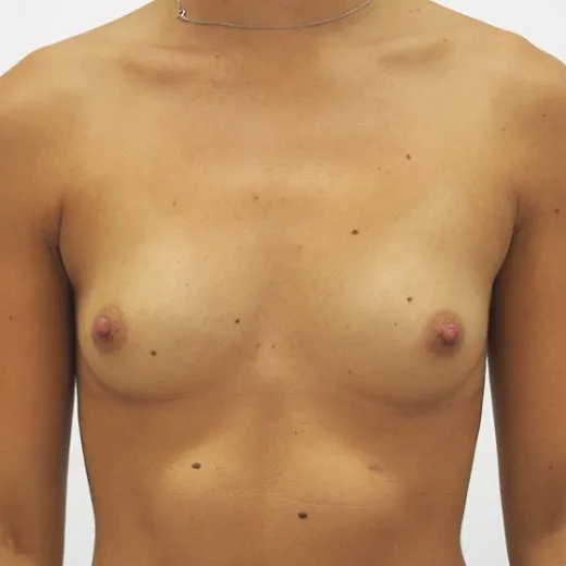 Image before