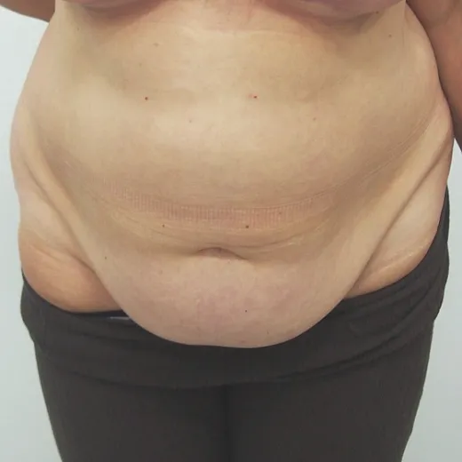 Image before