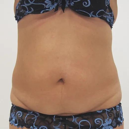 Image before