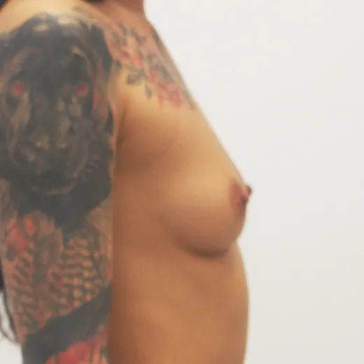 Image before