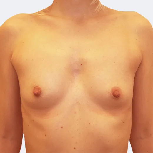 Image before