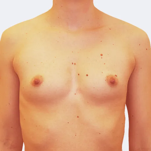 Image before