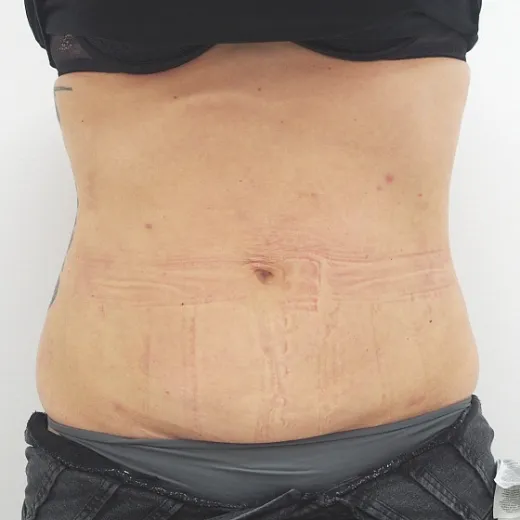 Image after
