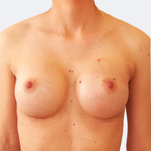 Image after
