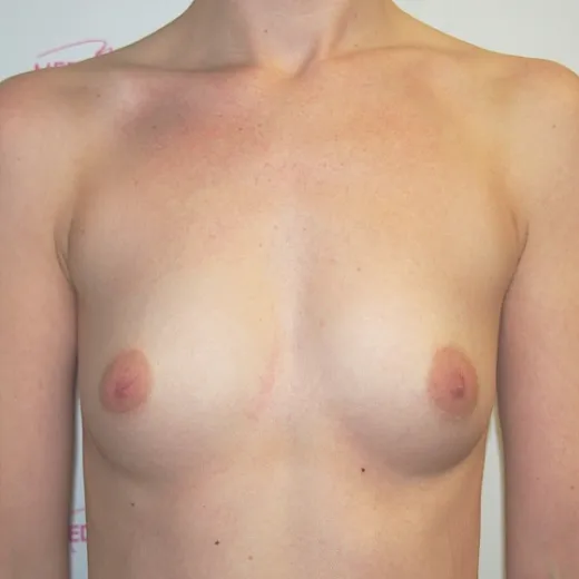 Image before