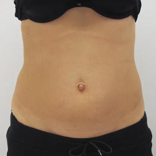 Image before