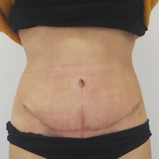 Image after