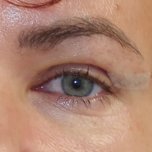 Image after
