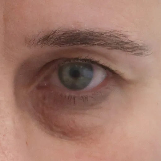 Image before