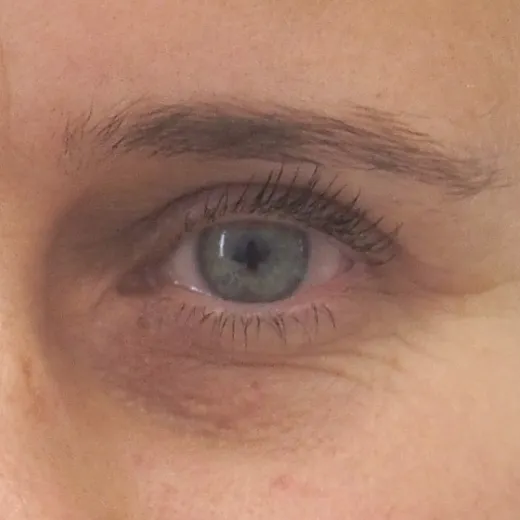Image after