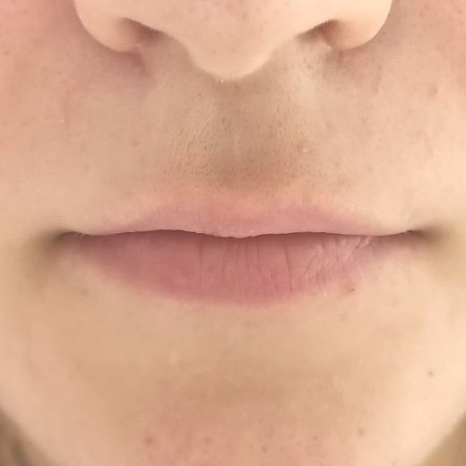 Image before