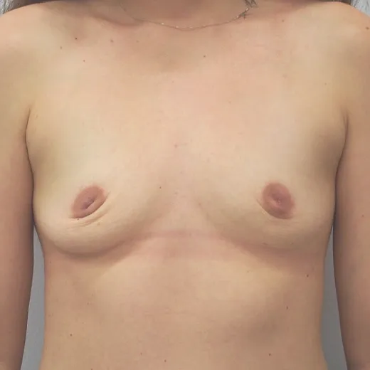 Image before