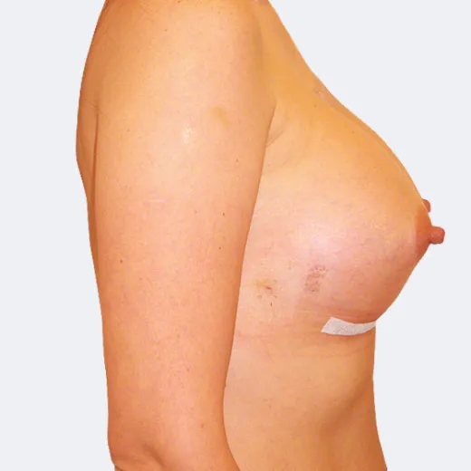 Image after